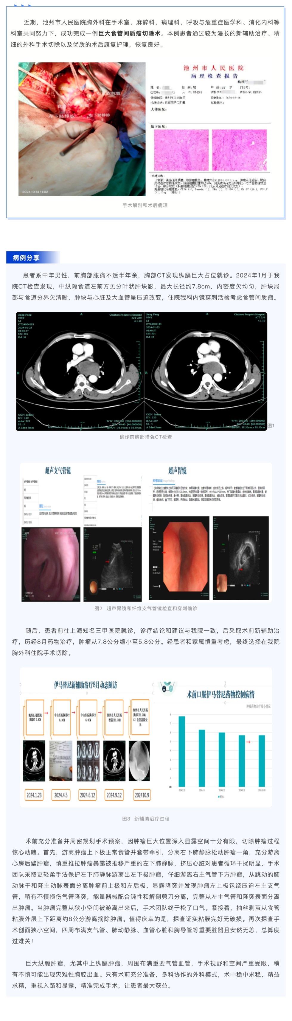 池州市人民醫(yī)院胸外科成功完成新輔助治療后巨大食管間質(zhì)瘤切除術(shù)_壹伴長圖1.jpg
